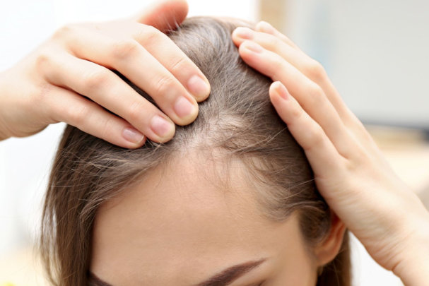 PRP gegen Haarausfall